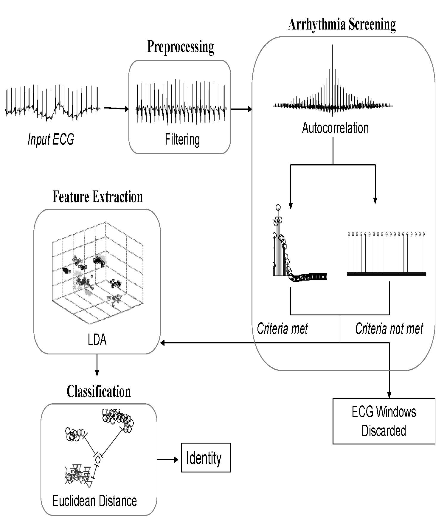 ECG