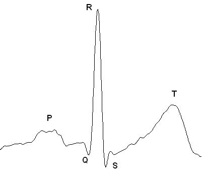 ECG