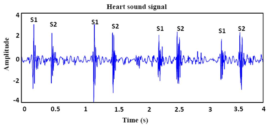 ECG